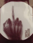 xrayfinger_205.jpg