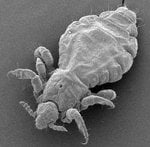 body louse.jpg