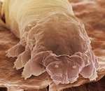 eyelash_mite.jpg