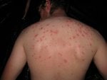 1_1201710900_i-love-bed-bugs.jpg