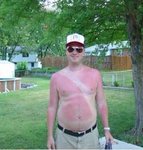 bad-tan-lines.jpg
