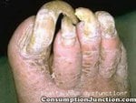 2007514154432_toenails.jpg