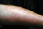 arm1.jpg