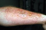 arm2.jpg